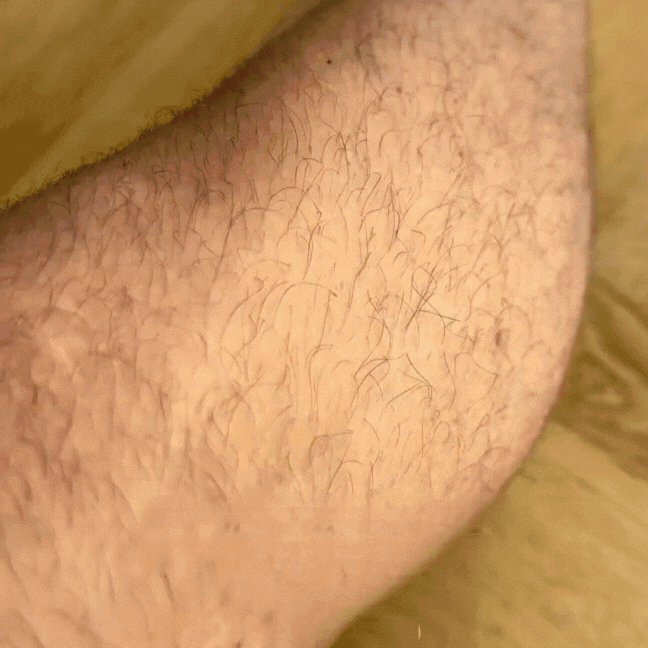 Nouvaa Razor - Bump-free shaving, smoothness that lasts