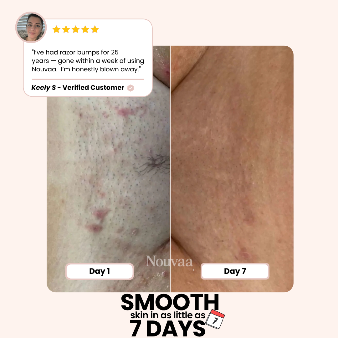 Nouvaa Razor - Bump-free shaving, smoothness that lasts