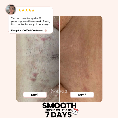 Nouvaa Razor - Bump-free shaving, smoothness that lasts
