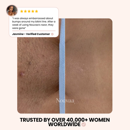 Nouvaa Razor - Bump-free shaving, smoothness that lasts